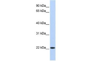 Western Blotting (WB) image for anti-Synovial Sarcoma, X Breakpoint 5 (SSX5) antibody (ABIN2458407) (SSX5 antibody)