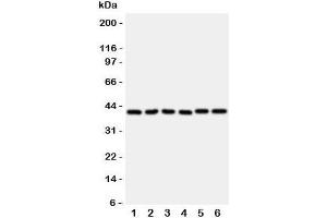 Western blot testing of WISP1 antibody and rat samples 1: heart;  2: kidney;  3: lung;  and human samples 4: A549;  5: A431;  6: COLO320 cell lysate (WISP1 antibody  (C-Term))