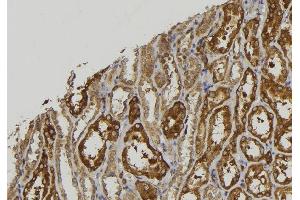 ABIN6279256 at 1/100 staining Mouse kidney tissue by IHC-P. (CPXM2 antibody)