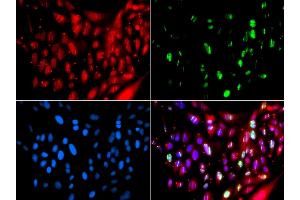 Immunofluorescence analysis of GFP-RNF168 transgenic U2OS cells using UIMC1 antibody (ABIN5974363). (UIMC1 antibody)