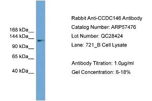 WB Suggested Anti-CCDC146  Antibody Titration: 0.
