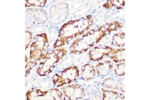 Immunohistochemistry of paraffin-embedded mouse kidney using  Rabbit mAb (ABIN7265591) at dilution of 1:100 (40x lens). (ANGPTL3 antibody)