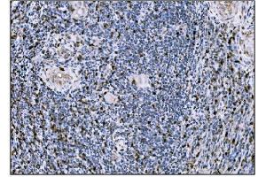 IHC analysis of Fos B/FOSB using anti-Fos B/FOSB antibody (ABIN7599279).