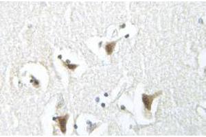 Image no. 2 for anti-Synuclein, alpha (SNCA) antibody (ABIN317944) (SNCA antibody)