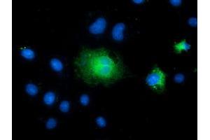 Anti-TCTN2 mouse monoclonal antibody (ABIN2453721) immunofluorescent staining of COS7 cells transiently transfected by pCMV6-ENTRY TCTN2 (RC203860). (TCTN2 antibody)