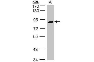 WB Image Sample(30 ug whole cell lysate) A:Hep G2 , 7. (Glucose-6-Phosphate Dehydrogenase antibody)