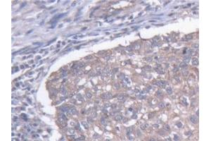 Immunohistochemistry (IHC) image for anti-Microtubule-Associated Protein 1B (MAP1B) (AA 2207-2468) antibody (ABIN7444904)