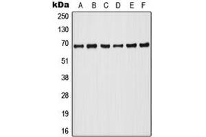 Western blot analysis of A-RAF (pY302) expression in HeLa PMA-treated (A), Raji (B), HT29 (C), NIH3T3 (D), SP2/0 PMA-treated (E), PC12 PMA-treated (F) whole cell lysates. (ARAF antibody  (pTyr302))