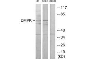 Western blot analysis of extracts from Jurkat/COLO205 cells, using DMPK Antibody. (DMPK antibody  (AA 11-60))