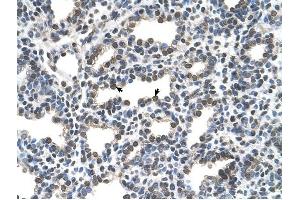 KCTD6 antibody was used for immunohistochemistry at a concentration of 16. (KCTD6 antibody  (N-Term))