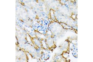 Immunohistochemistry (IHC) image for anti-alpha-2-Macroglobulin (A2M) antibody (ABIN7265558)