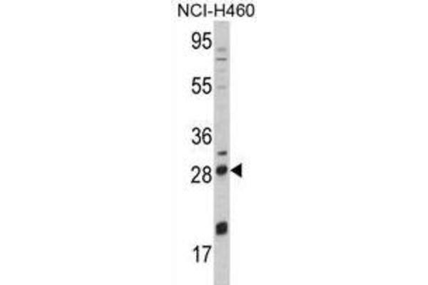 NGFB antibody