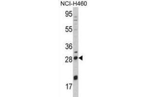 Western Blotting (WB) image for anti-Nerve Growth Factor beta (NGFB) antibody (ABIN3003483)
