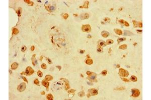 Immunohistochemistry of paraffin-embedded human placenta tissue using ABIN7173756 at dilution of 1:100 (TINAGL1 antibody  (AA 250-467))