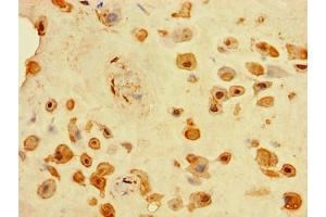 Immunohistochemistry of paraffin-embedded human placenta tissue using ABIN7173756 at dilution of 1:100