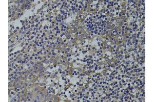 Immunohistochemistry of paraffin-embedded human tonsil using GNA15 antibody (ABIN1872841) at dilution of 1:100 (40x lens). (GNA15 antibody)