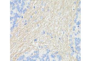 Immunohistochemistry of paraffin-embedded Rat brain using THY1 Polyclonal Antibody at dilution of 1:100 (40x lens). (CD90 antibody)