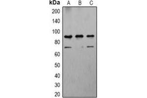 Western blot analysis of Calnexin expression in Hela (A), NIH3T3 (B), PC12 (C) whole cell lysates. (Calnexin antibody)