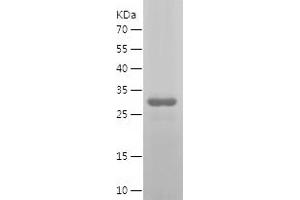 Western Blotting (WB) image for Signal Transducer and Activator of Transcription 6, Interleukin-4 Induced (STAT6) (AA 2-281) protein (His tag) (ABIN7125096) (STAT6 Protein (AA 2-281) (His tag))