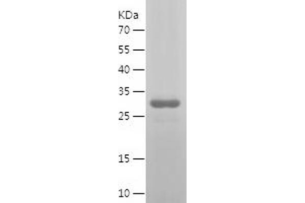 STAT6 Protein (AA 2-281) (His tag)