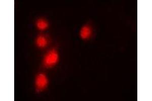 Immunofluorescent analysis of Pontin 52 staining in A549 cells. (RUVBL1 antibody)