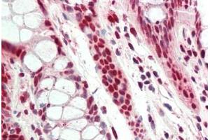 Immunohistochemistry (IHC) image for anti-Acidic (Leucine-Rich) Nuclear phosphoprotein 32 Family, Member A (ANP32A) (AA 121-170) antibody (ABIN1923417)