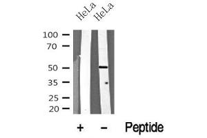 Western blot analysis of MST3 in lysates of HeLa? (STK24 antibody  (N-Term))