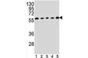 PAX1 antibody western blot analysis in (1) HepG2, (2) MDA-MB453, (3) 293, (4) K562 and (5) MCF-7 lysate. (PAX1 antibody  (AA 443-471))