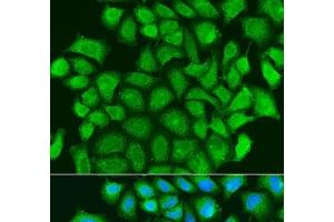 Immunofluorescence analysis of U2OS cells using TRAF3 Polyclonal Antibody at dilution of 1:100. (TRAF3 antibody)