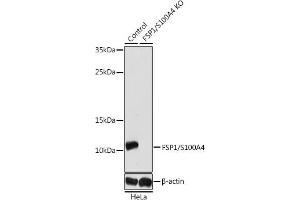 Western blot analysis of extracts from normal (control) and FSP1/S100 knockout (KO) HeLa cells, using FSP1/S100 antibody (ABIN3022287, ABIN3022288, ABIN3022289, ABIN1513494 and ABIN1514638) at 1:1000 dilution. (s100a4 antibody  (AA 1-101))