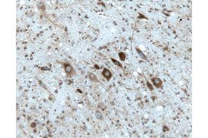 Rat cerebellum, formalin-fixed paraffin embedded tissue, with citrate pre-treatment, 20X. (Gephyrin antibody  (AA 569-726))
