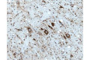 Rat cerebellum, formalin-fixed paraffin embedded tissue, with citrate pre-treatment, 20X. (Gephyrin antibody  (AA 569-726))