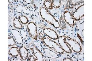 Image no. 5 for anti-Bruton Agammaglobulinemia tyrosine Kinase (BTK) antibody (ABIN1496974) (BTK antibody)