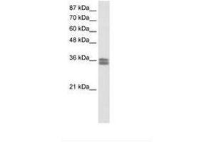 Image no. 1 for anti-Calcium Channel, Voltage-Dependent, gamma Subunit 4 (CACNG4) (AA 51-100) antibody (ABIN202252) (CACNG4 antibody  (AA 51-100))