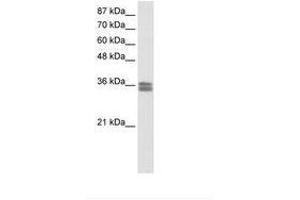 Image no. 1 for anti-Calcium Channel, Voltage-Dependent, gamma Subunit 4 (CACNG4) (AA 51-100) antibody (ABIN202252)