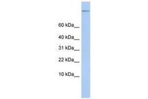 Image no. 1 for anti-TSC22 Domain Family, Member 1 (TSC22D1) (C-Term) antibody (ABIN6740393) (TSC22D1 antibody  (C-Term))