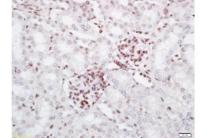 Formalin-fixed and paraffin embedded mouse kidney labeled with Rabbit Anti-PRMT6 Polyclonal Antibody, Unconjugated (ABIN761876) at 1:200 followed by conjugation to the secondary antibody and DAB staining
