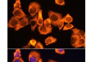 Immunofluorescence (IF) image for anti-Ribosomal Protein S3 (RPS3) antibody (ABIN7257140)