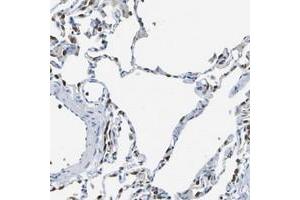 Immunohistochemical staining of human lung with ABHD3 polyclonal antibody  shows strong cytoplasmic positivity in a subset of alveolar cells. (ABHD3 antibody)
