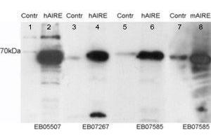 ABIN2560996 staining (0. (AIRE antibody  (Internal Region, Isoform 1))