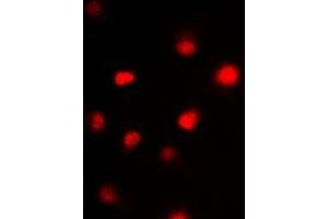 Immunofluorescent analysis of GATA3 staining in HeLa cells. (GATA3 antibody  (Center))