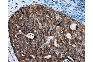 Immunohistochemical staining of paraffin-embedded Kidney tissue using anti-RALBP1 mouse monoclonal antibody. (RALBP1 antibody)