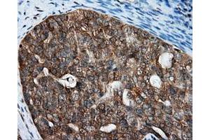 Immunohistochemical staining of paraffin-embedded Kidney tissue using anti-RALBP1 mouse monoclonal antibody.