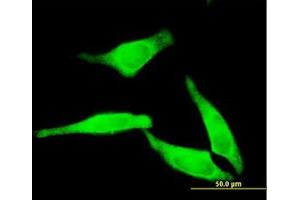 Image no. 1 for anti-5'-Nucleotidase, Cytosolic II (NT5C2) (AA 1-562) antibody (ABIN599188) (NT5C2 antibody  (AA 1-562))