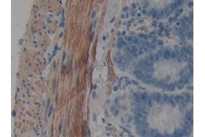DAB staining on IHC-P; Samples: Rat Intestine Tissue (WIF1 antibody  (AA 38-247))