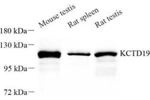 Western blot analysis of KCTD19 (ABIN7075147) at dilution of 1: 50 (KCTD19 antibody)