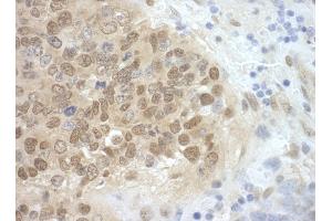 Immunohistochemistry (IHC) image for anti-Cell Division Cycle 6 Homolog (S. Cerevisiae) (CDC6) (AA 1-50) antibody (ABIN7448469) (CDC6 antibody  (AA 1-50))