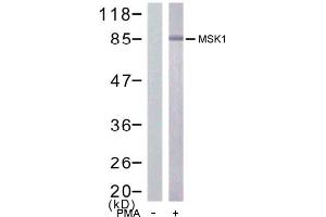 Image no. 1 for anti-Ribosomal Protein S6 Kinase, 90kDa, Polypeptide 5 (RPS6KA5) (Ser376) antibody (ABIN197423) (MSK1 antibody  (Ser376))