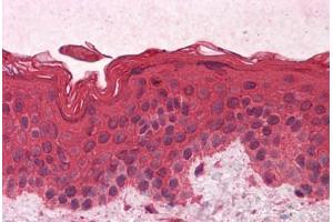 Human Skin: Formalin-Fixed, Paraffin-Embedded (FFPE) (GNAI1 antibody  (AA 1-355))