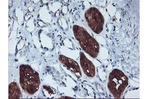 Immunohistochemical staining of paraffin-embedded Human Kidney tissue using anti-GBA3 mouse monoclonal antibody. (GBA3 antibody  (AA 1-150, AA 370-469))